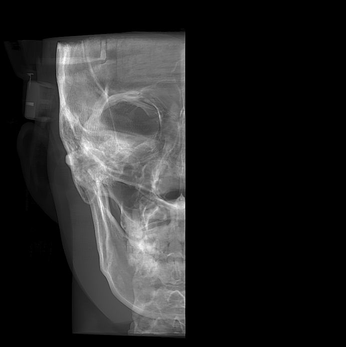 Frontal right cephalometric view