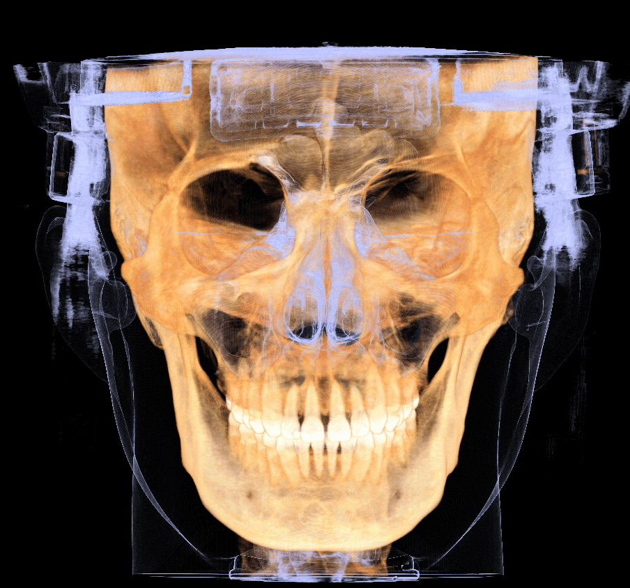 Dentition and soft tissue rendering