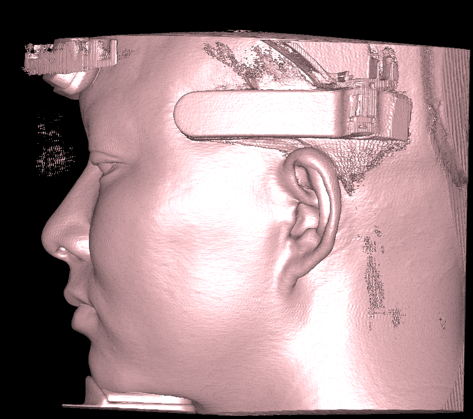 Soft tissue rendering mode two