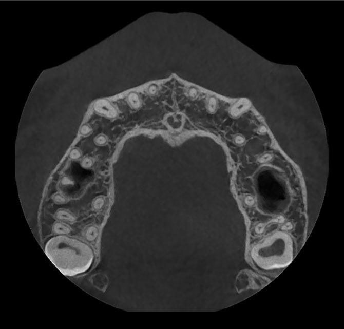 High-resolution axial dental CT image