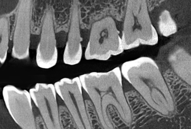 Leading 40 lp/cm Ultra-High-Resolution Imaging