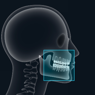 Frontal and lateral view