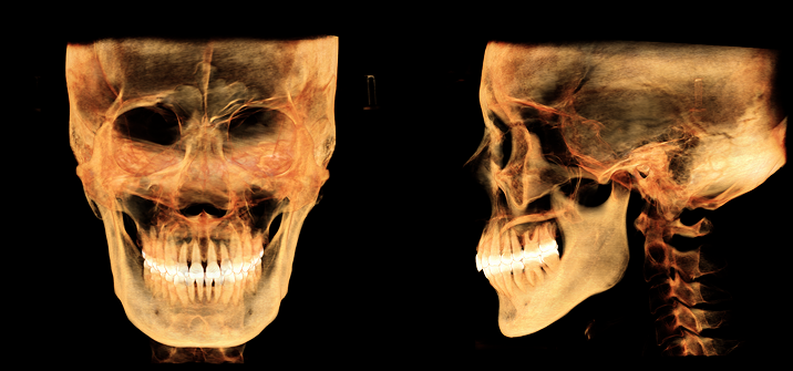Dentition rendering